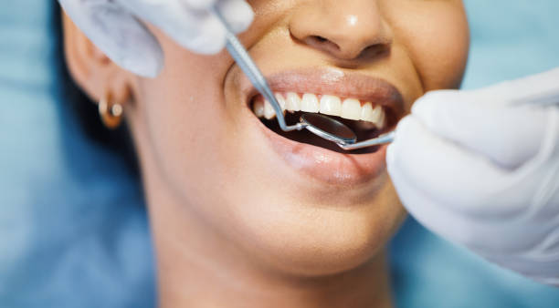 Best Emergency Root Canal Treatment in Danbury, TX
